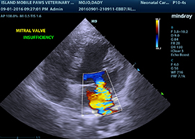 Ultrasound of Liver